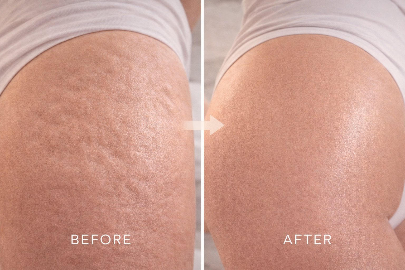 Veluna Body Ritual Before and After Results - Real Transformation